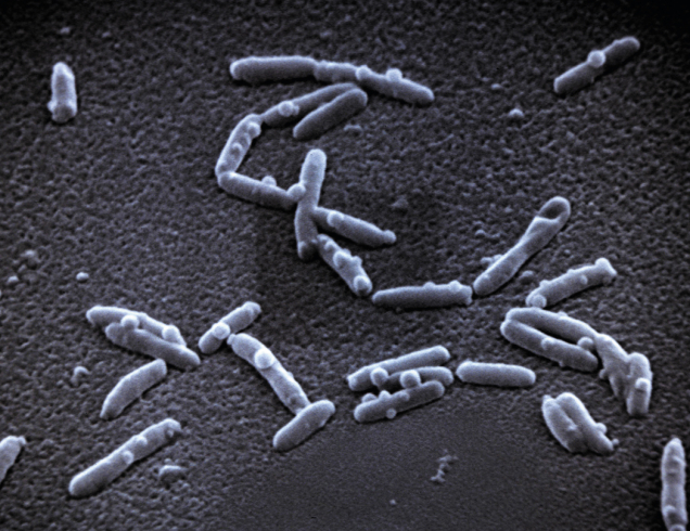 Legionella pneumophila je parazit, který vniká do lidských buněk a způsobuje tzv. legionářskou nemoc. Ta má podobný průběh jako zápal plic. Pro lidi s oslabenou imunitou představuje životu nebezpečné onemocnění. (Foto: Viega)